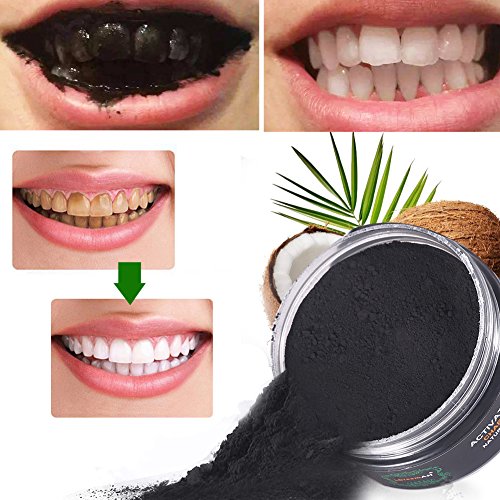 SmileBright™ – Tu sonrisa más blanca de forma segura y natural