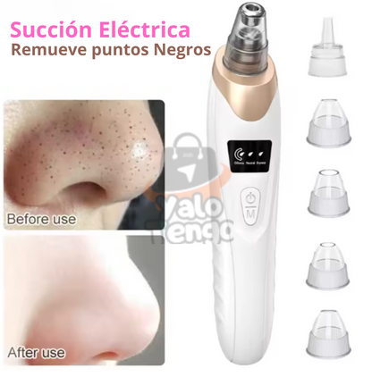 ClearSkin Pro™ - Extractor de impurezas y puntos negros