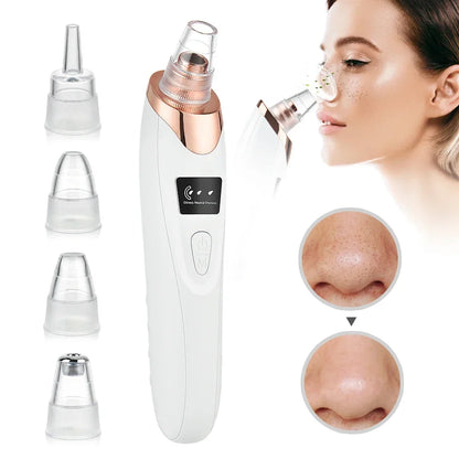 ClearSkin Pro™ - Extractor de impurezas y puntos negros